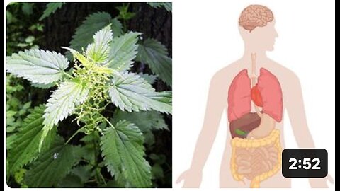 Health Benefits of Stinging Nettle (Urtica Dioica)