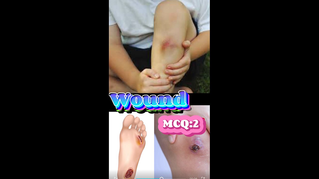 Wound MCQS #wound #woundstage #quiz #mcqs #Nclex #nurses #doctor #short, #3Dmedico #shorts