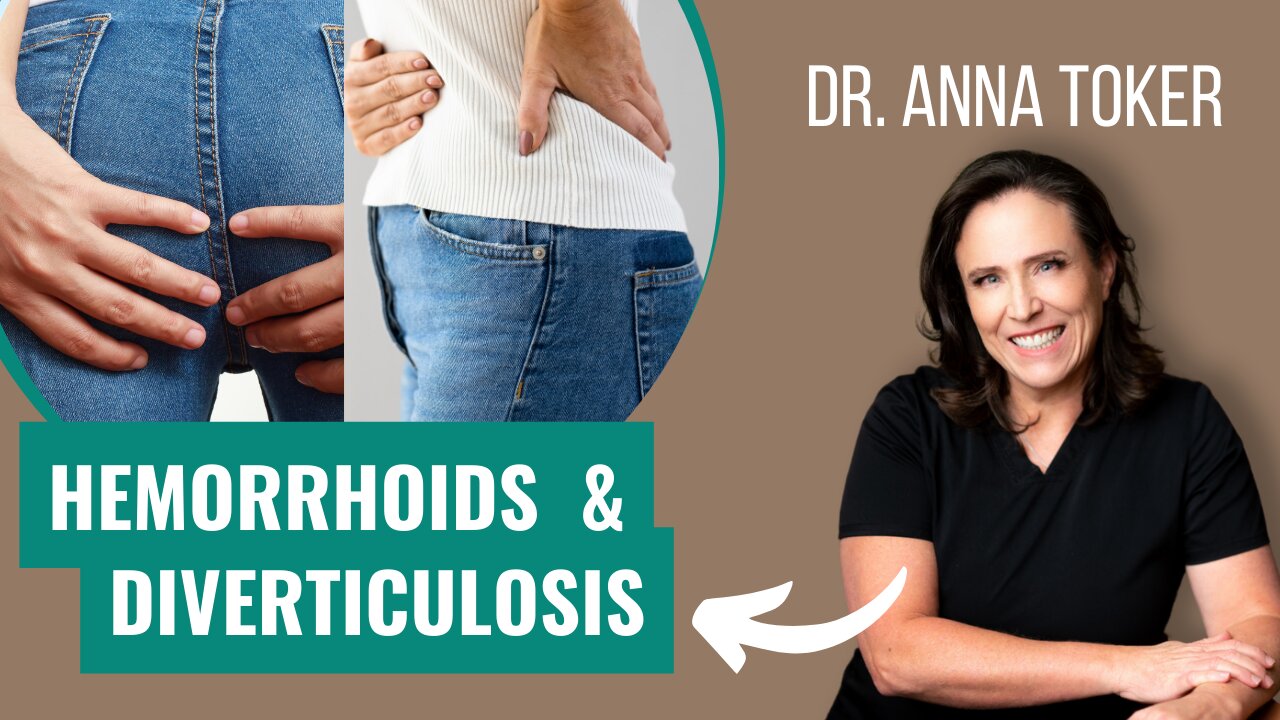 Hemorrhoids & Diverticulosis