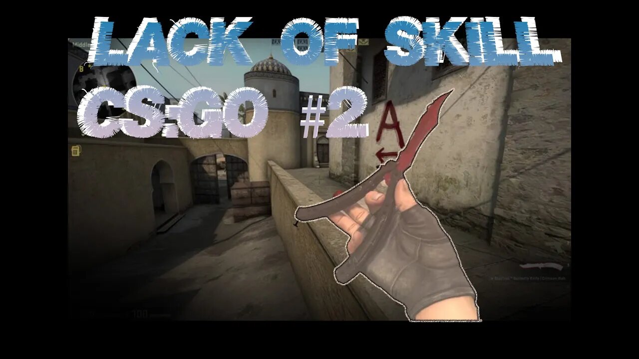 Lack of Skill: CSGO 2