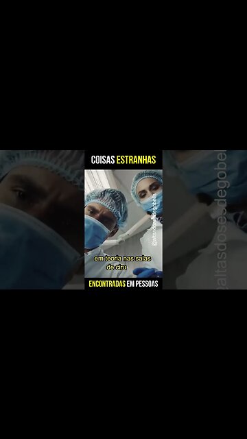Coisas estranhas encontradas em pessoas Part 01 - #shorts #viral #comidasaudavel