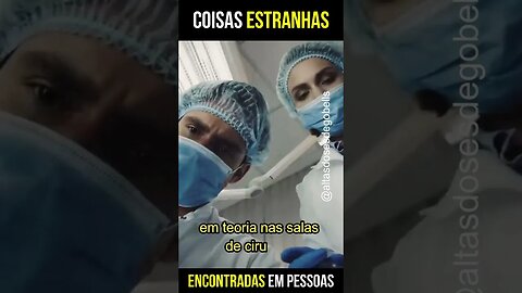 Coisas estranhas encontradas em pessoas Part 01 - #shorts #viral #comidasaudavel