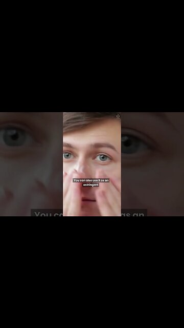 Rub Aloe Vera On Your Face To Get Rid Of Acne Fast