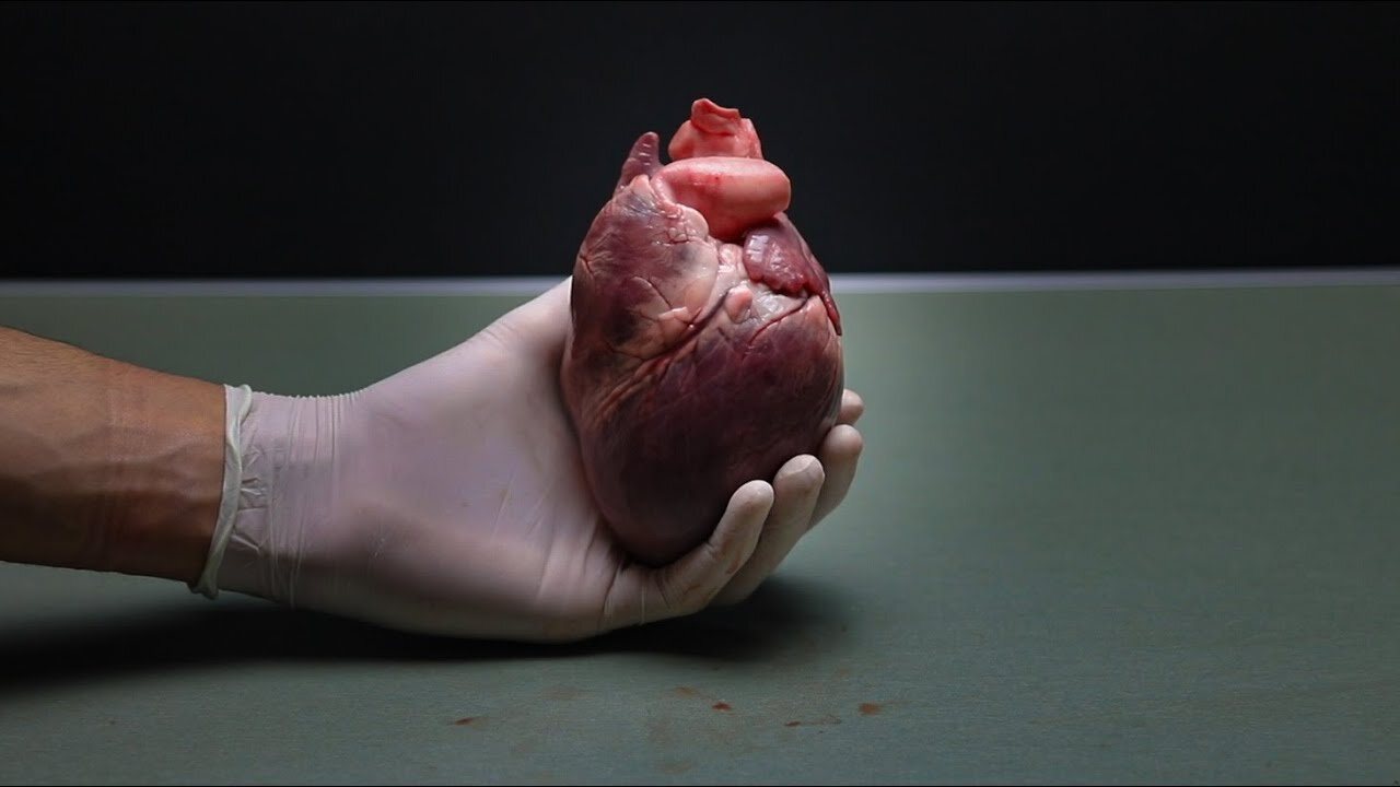 Dissection of the Heart: An Introduction