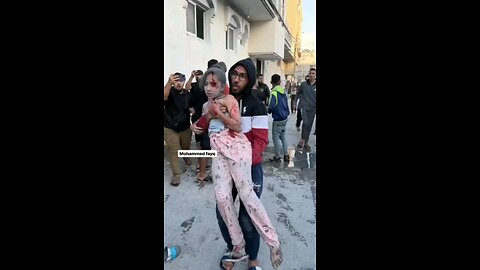 أطفال أصيبوا جراء قصف الاحتلال لمدينة رفح جنوبي قطاع غزة