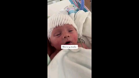 Thisis a babyat 34weeks Kamala thinks it’sokay to havean AB0RTl0N this late and endthis baby’s life.