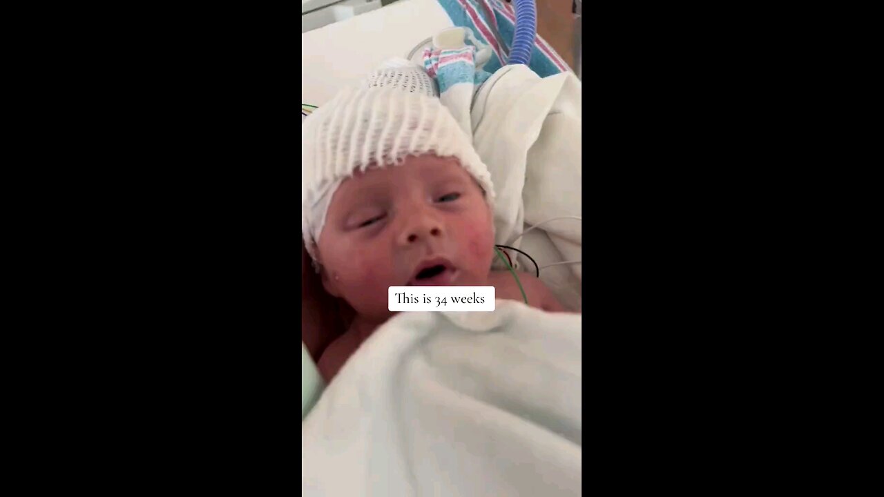 Thisis a babyat 34weeks Kamala thinks it’sokay to havean AB0RTl0N this late and endthis baby’s life.
