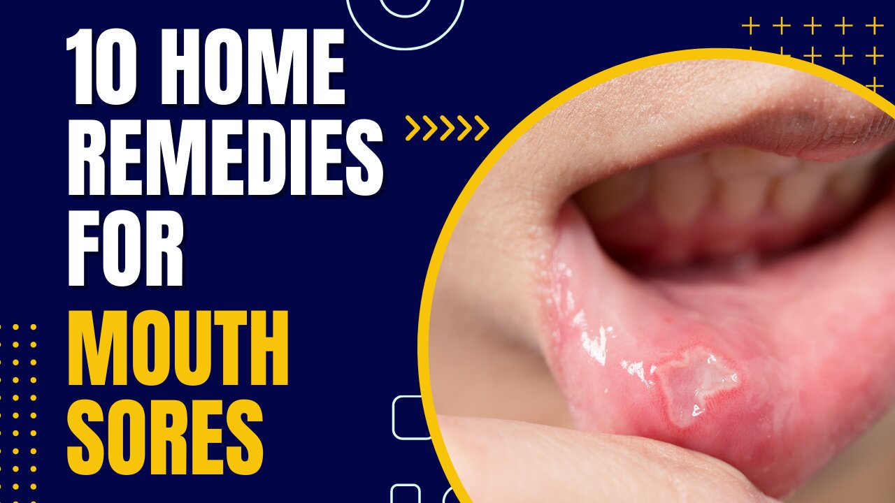 10 Home Remedies for Mouth Sores You Haven't Tried Yet!