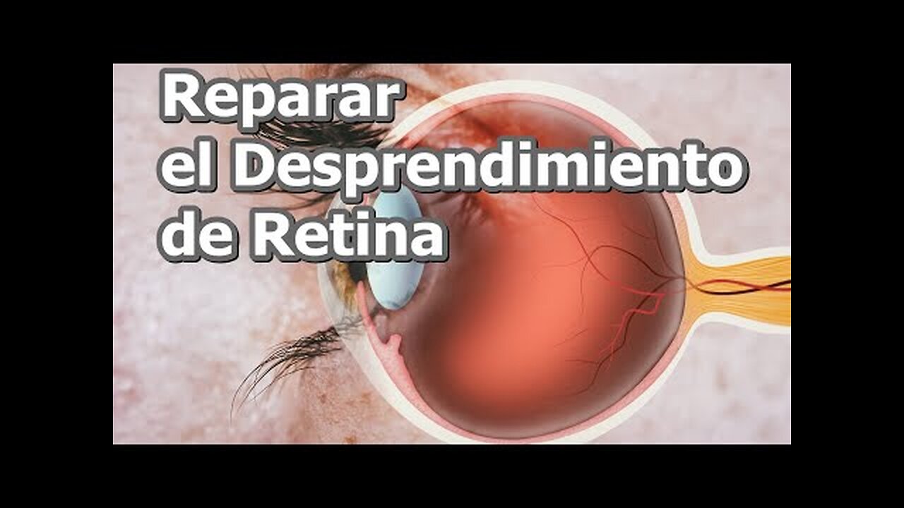 LA CURA DEL DESPRENDIMIENTO DE RETINA Y LAS CAUSAS, INCLUIDA LA EMOCIONAL