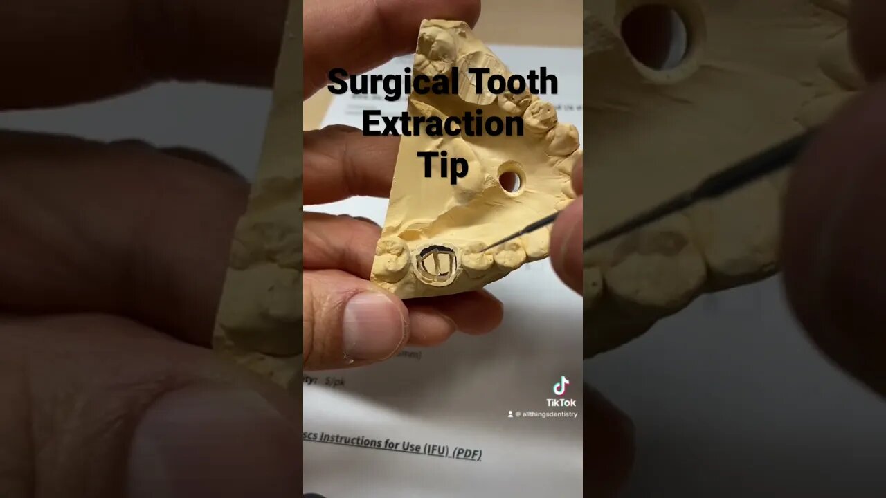 Simpler Surgical Extractions #dentistry