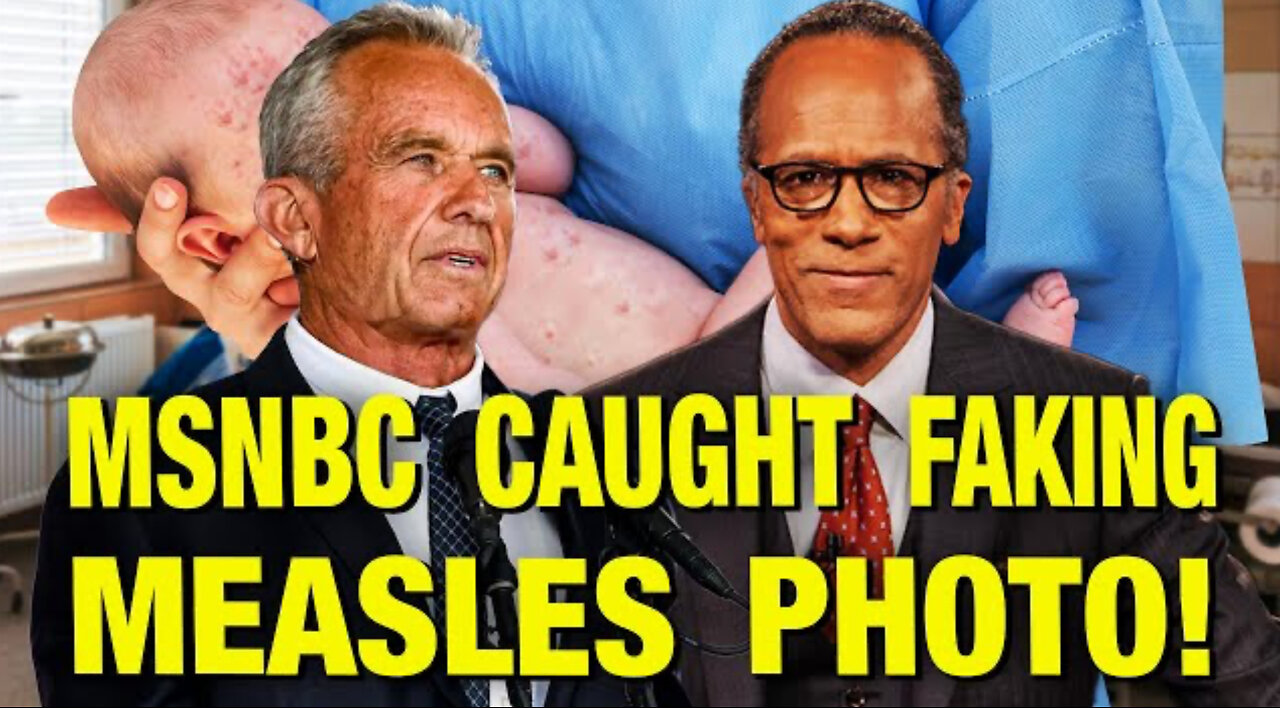 NBC Doctored Up This Photo Of A Baby With Measles!