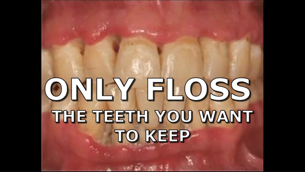 ONLY FLOSS THE TEETH YOU WANT TO KEEP