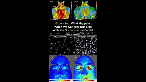 Groudning: What Happens When We Connect Our Skin With The Surface Of The Earth?