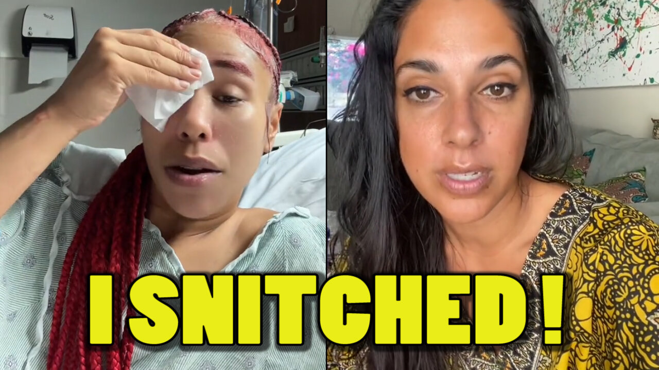 People Reacts To Getting Shot In The Hood #2