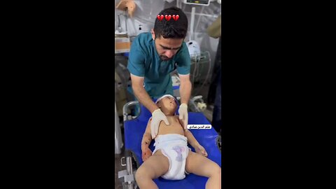 محاولة الأطباء إنقاذ طفل مصاب بجروح خطيرة جراء قصف منزلهم بمخيم الشابورة في رفح