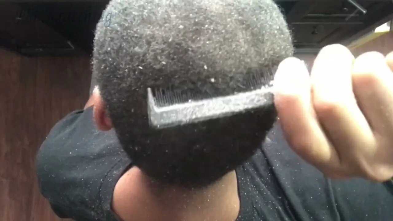 Itchy Dandruff Scratching