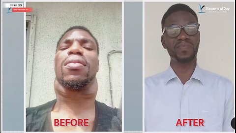 DIVINE SURGERY IN THE NECK 🧣 GROWTH DISAPPEARED § WHAT GOD CANNOT DO DOES NOT EXIST 🔥#nsppd