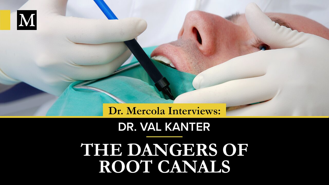 Root Canal Dangers — Interview with Dr. Val Kanter