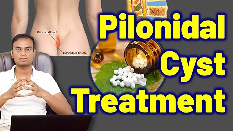Homeopathy Advantages in Treating Pilonidal Cyst Sinus Abscesses | Treatment Cure Medicine Surgery