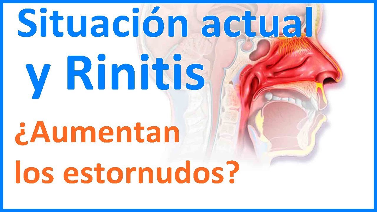 RINITIS NO ALÉRGICA Y ALÉRGICA TODAS LAS CAUSAS Y REMEDIO NATURAL