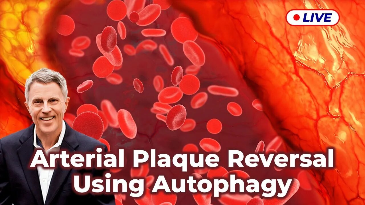 Arterial Plaque Reversal Using Autophagy (LIVE)