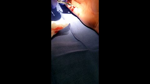 Getting stitched up