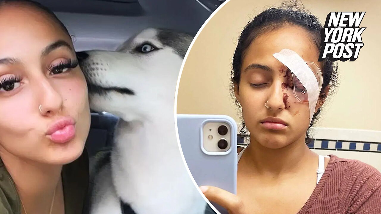 Florida woman loses eye after freak accident with retractable dog leash