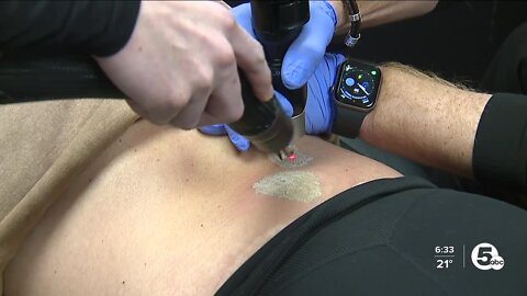 Medical spa removes tattoos forced on human trafficking survivors by abusers