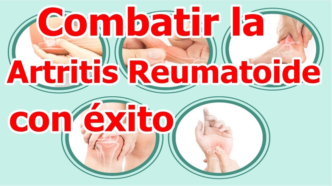 ARTRITIS REUMATOIDE - SÍNTOMAS - TODAS LAS CAUSAS Y EL TRATAMIENTO EFECTIVO