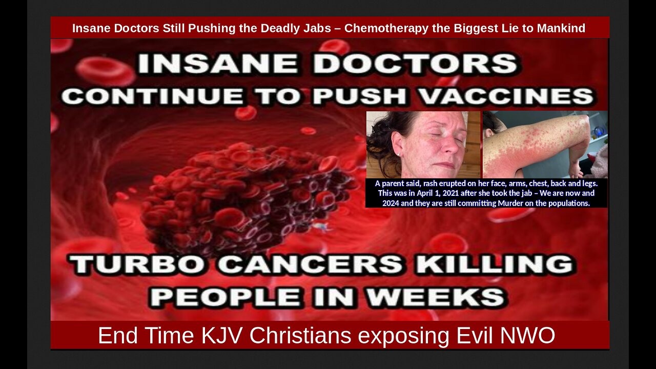 Insane Doctors Still Pushing the Deadly Jabs – Chemotherapy the Biggest Lie to Mankind