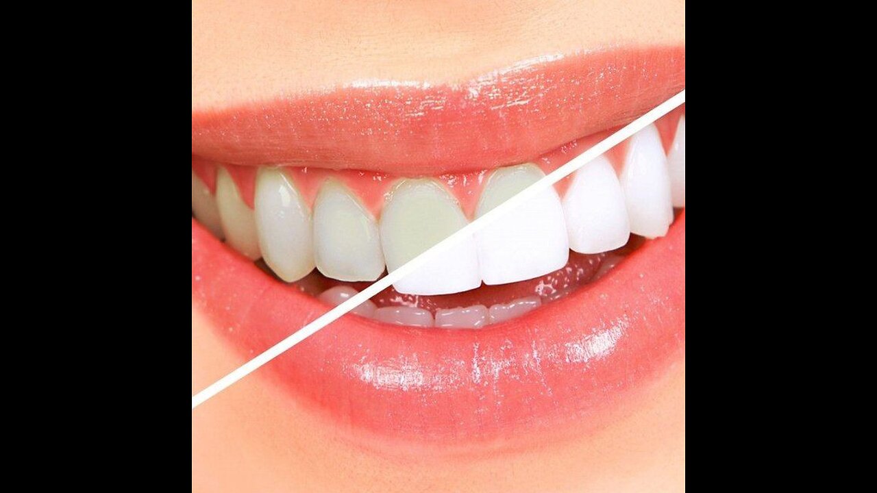 The best way to whiten teeth link in description [2023]