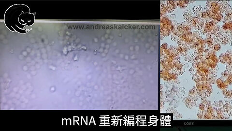 mRNA 疫苗對血液的影響 (2021), Dr. Aaron Lewis