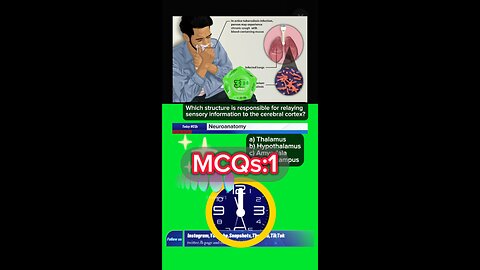 Neurological mcqs #mcqs #medicine #doctors #nurses