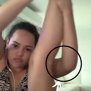 Sexy Yoga Fails KNEE Hits Her Face. #foryou #rumble #sexyyoga #yogafail