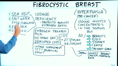 Fibrocystic Breast: The Best Remedy is...Iodine [Mirrored]