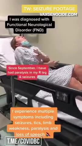 COVID 백신을 접종한 후 기능적 신경 장애, 오른쪽 다리 마비, 진드기 및 발작 장애가 온 23세 살 여 의대생