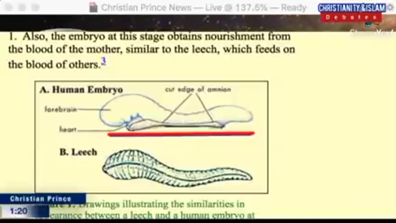 A Medical Doctor Showed an Evidence for Scientific Knowledge in Quran