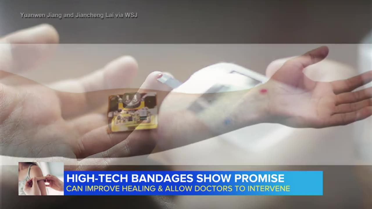 'Smart bandages' aim to improve healing and medical intervention ABC News