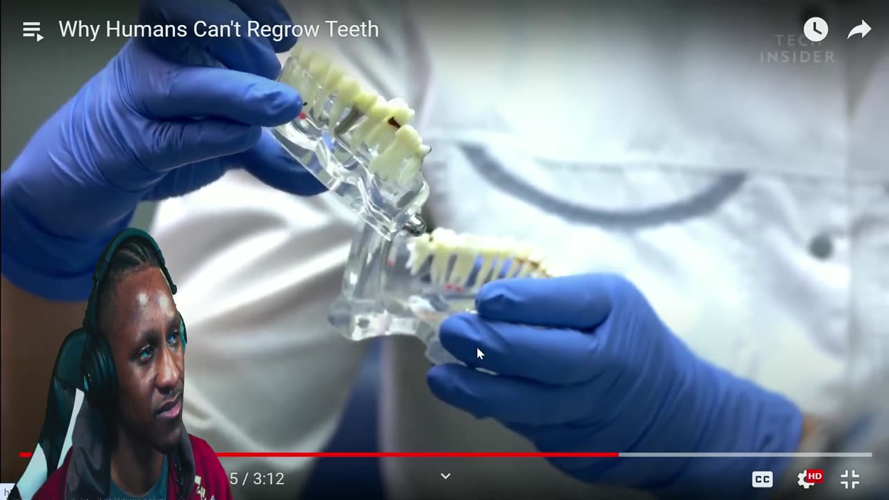 Why Humans Can't Regrow Teeth