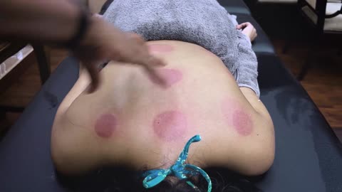 Female Cupping Back Massage for Pain Relief _ Indian Massage