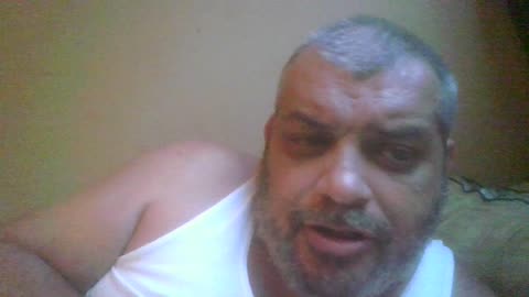 Famous Pop Singer Joins The “Black Eye Club”