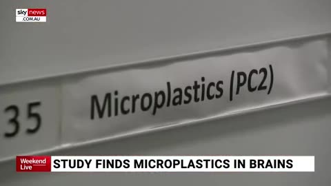 Study On Microplastics Reveal Their Shocking Impact On The Human Brain