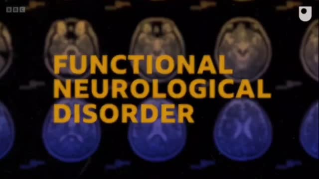 Functional Neurological Disorder (FND)