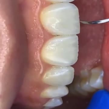 dental - healthy teeth