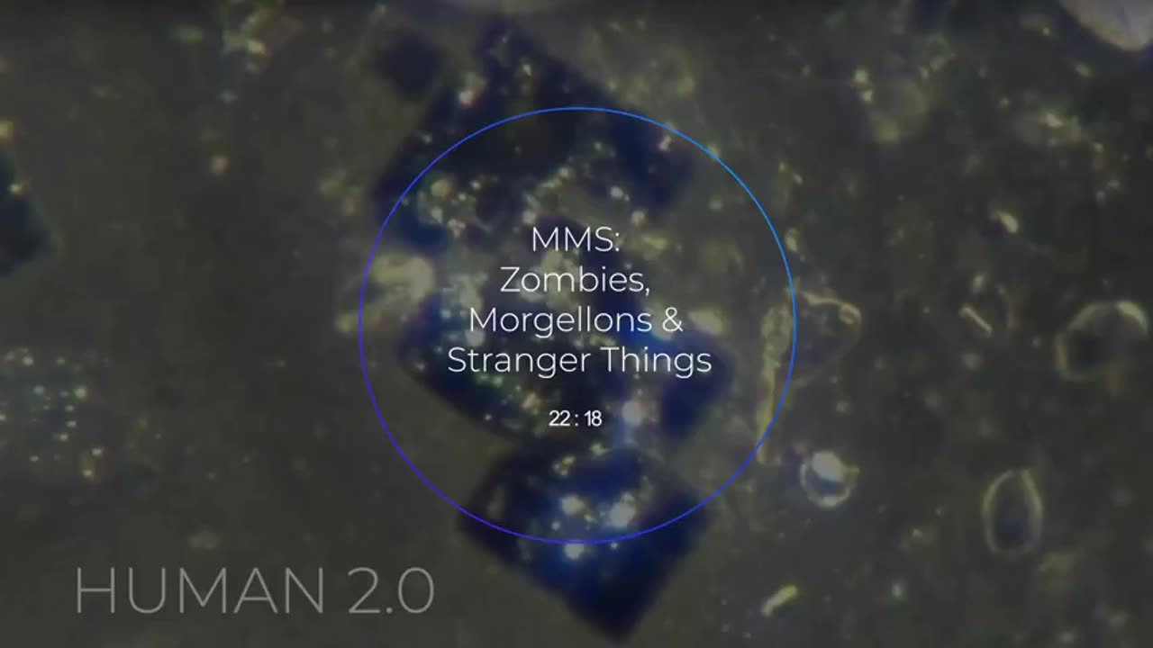 S4 95. ENOCH P ~ ZOMBIES, MORGELLONS & STRANGER THINGS