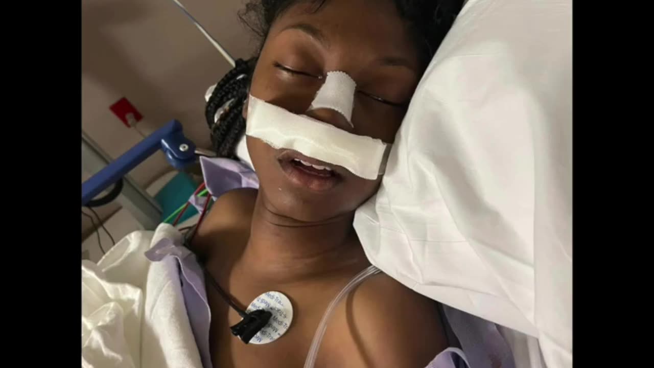 15 Year Old Girl McDonald’s Employee got a Fractured Skull After Man Stomps on Her Head