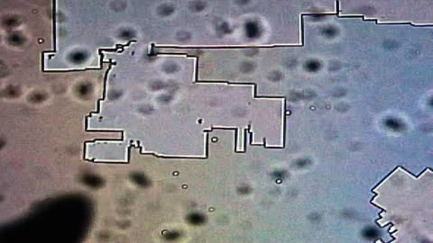 Microscopic images of strange fog particles; unknown pathogen being found in sick wild birds