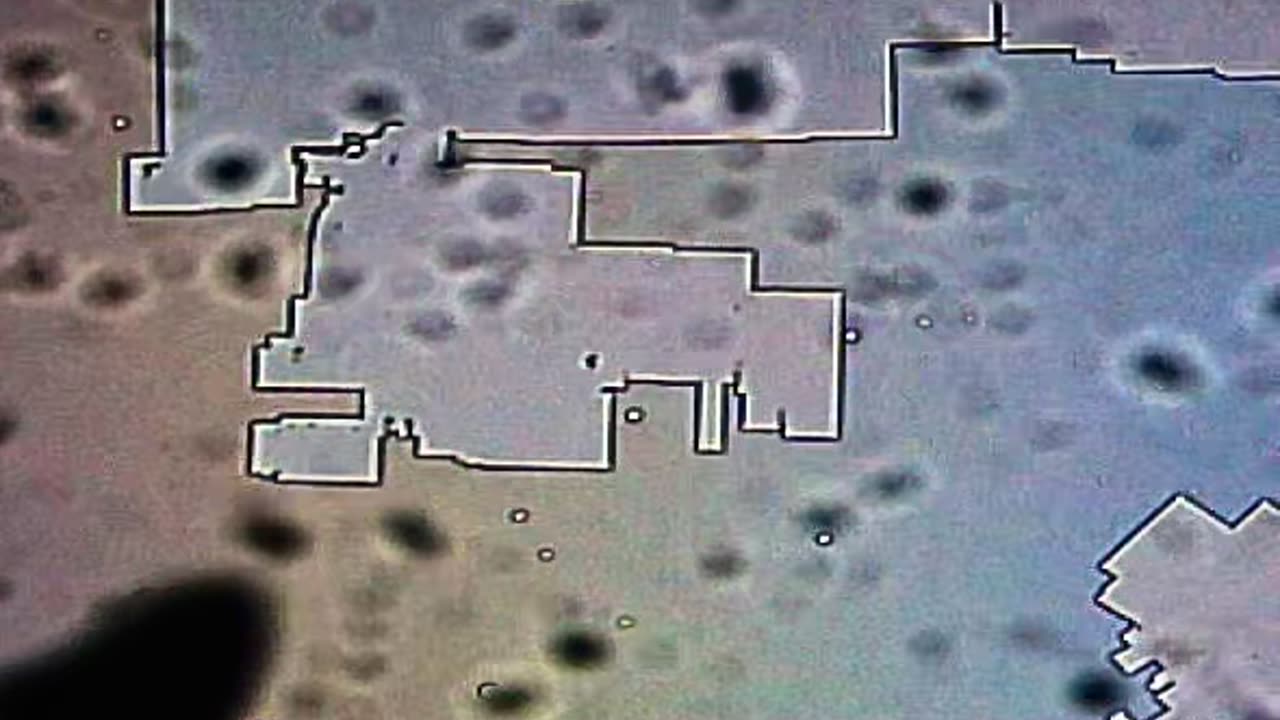 Microscopic images of strange fog particles; unknown pathogen being found in sick wild birds