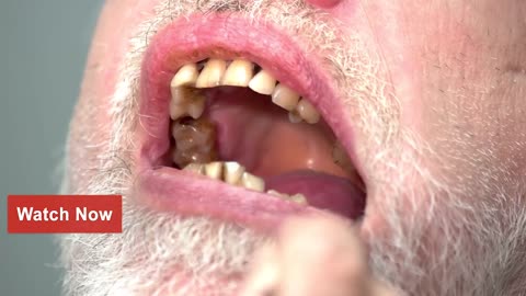 HUMAN: It’s What’s for Dinner!