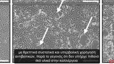 Ντοκυμαντέρ: "Το Τέλος της Θεωρίας των Μικροβίων / Ιών"